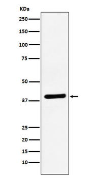 VEGFD Rabbit Monoclonal Antibody
