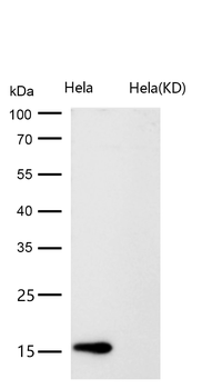 CDKN2C Rabbit mAb [KD Validated] Antibody