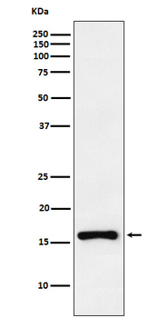 CDKN2C Rabbit mAb [KD Validated] Antibody