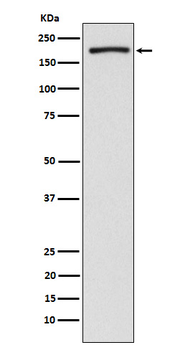 EHMT2/G9A Rabbit mAb [KD Validated] Antibody