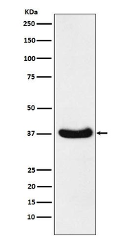 AKR1C3 Rabbit mAb Antibody