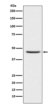 CCR8 Rabbit Monoclonal Antibody