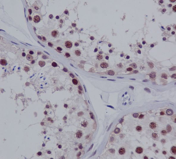 PIAS1 + PIAS2 Rabbit mAb Antibody