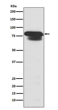 PIAS1 + PIAS2 Rabbit mAb Antibody