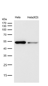 Caspase-2 Rabbit mAb [KD Validated] Antibody