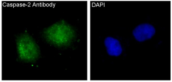 Caspase-2 Rabbit mAb [KD Validated] Antibody