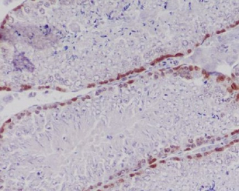Caspase-2 Rabbit mAb [KD Validated] Antibody