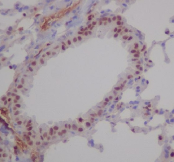 RUNX1/RUNX2/RUNX3 Rabbit mAb [KD Validated] Antibody
