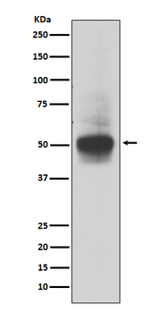 RUNX1/RUNX2/RUNX3 Rabbit mAb [KD Validated] Antibody