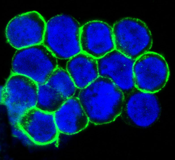 CXCR4 Rabbit mAb Antibody