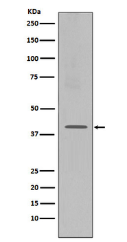 CXCR4 Rabbit mAb Antibody