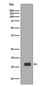 alpha + beta Synuclein Rabbit mAb Antibody