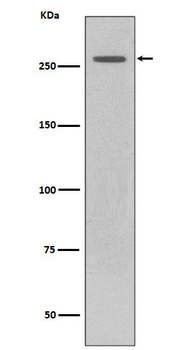 LRRK2 Rabbit mAb Antibody