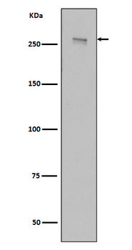 LRRK2 Rabbit mAb Antibody