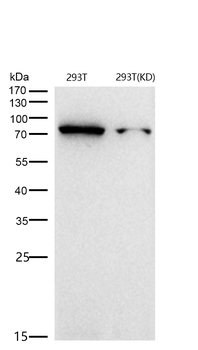 GRP78 BiP Rabbit Monoclonal Antibody