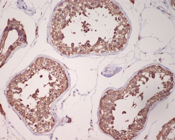 GRP78 BiP Rabbit Monoclonal Antibody