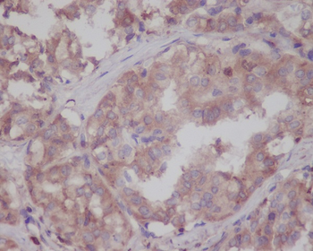 LRRK2 Rabbit mAb Antibody