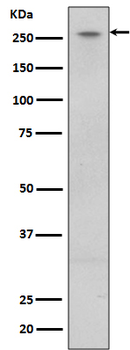 LRRK2 Rabbit mAb Antibody