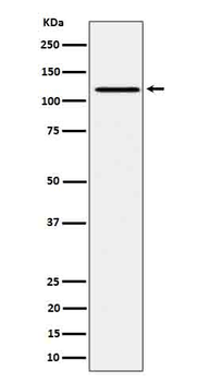 JAK1 (Phospho-Tyr1034/Tyr1035) Rabbit mAb Antibody