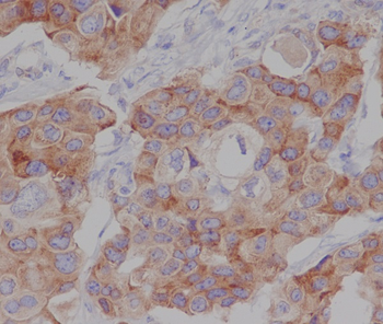 mTOR (Phospho-Ser2448) Rabbit mAb Antibody