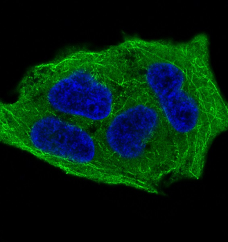 GSK3β(Phospho-Ser9) Rabbit mAb [KD Validated] Antibody