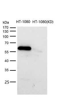 Smad2 (Phospho-Ser250) Rabbit mAb [KD Validated] Antibody
