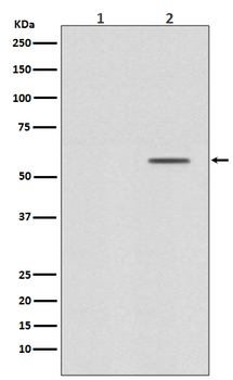 Smad2 (Phospho-Ser250) Rabbit mAb [KD Validated] Antibody