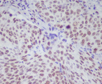 STAT1 (Phospho-Ser727) Rabbit mAb [KD Validated] Antibody
