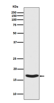 alpha Synuclein (Phospho-Ser129) Rabbit mAb Antibody