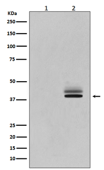 Erk1/2(Phospho-T202/Y204+T185/Y187) Rabbit mAb Antibody