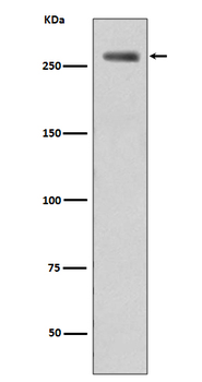 LRRK2 (Phospho-Ser935) Rabbit mAb Antibody