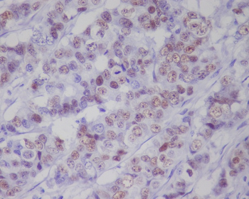 p53 (Phospho-Ser392) Rabbit mAb Antibody