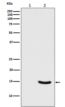 alpha Synuclein (Phospho-Ser129) Rabbit mAb Antibody