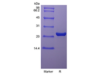 Recombinant Rat Oncostatin-M