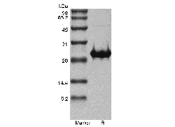 Recombinant Human Fibroblast Growth Factor 17