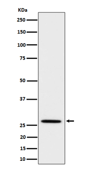 Adiponectin Rabbit mAb Antibody
