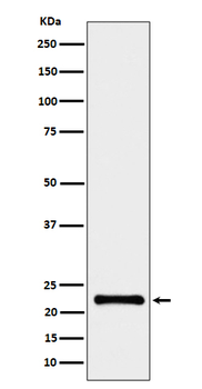 CRCP Rabbit Monoclonal Antibody