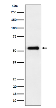 PRD Rabbit mAb [KD Validated] Antibody