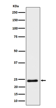 Mras Rabbit mAb [KD Validated] Antibody