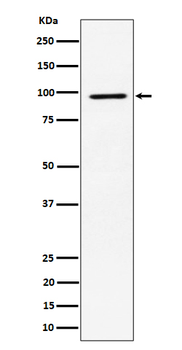 RSK2/RPS6KA3 Rabbit Monoclonal Antibody