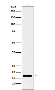 Histone H3 (acetyl K18) Rabbit mAb [KD Validated] Antibody