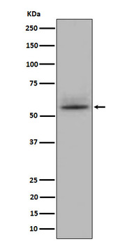 CD147 Rabbit mAb [KD Validated] Antibody