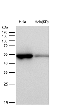 MLKL Rabbit mAb [KD Validated] Antibody