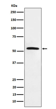 MLKL Rabbit mAb [KD Validated] Antibody