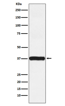 Arp2 Rabbit mAb [KD Validated] Antibody
