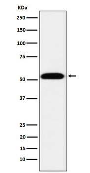 TEAD1 Rabbit mAb [KD Validated] Antibody