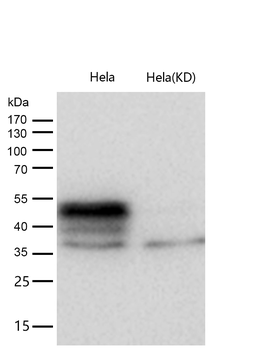 TEAD1 Rabbit mAb [KD Validated] Antibody