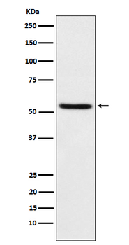 TEAD1 Rabbit mAb [KD Validated] Antibody
