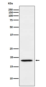 MTH1 Rabbit mAb [KD Validated] Antibody