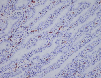 IBA1 Rabbit mAb Antibody